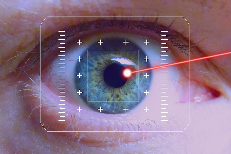 Chirurgie Laser Yeux